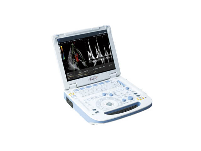 心臓・頸動脈超音波検査（エコー検査）